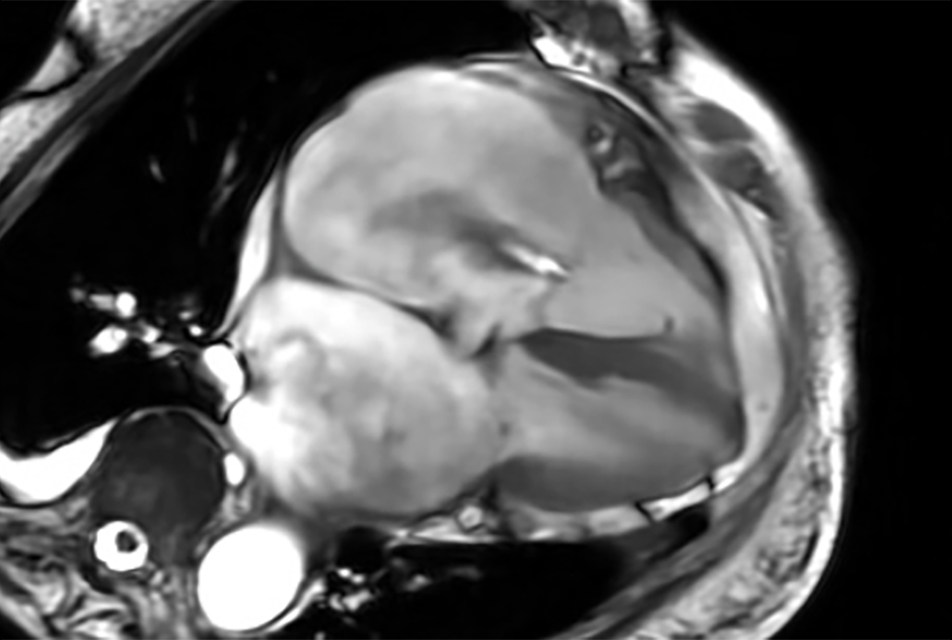 MRI image