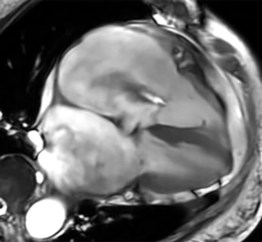 MRI image